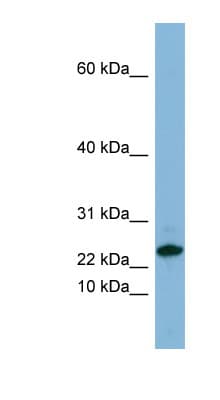 SPRR3 Antibody (C-Terminus)