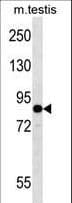 EIF2B5 Antibody (aa36-65)
