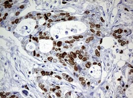 Monoclonal Mouse anti-Human MKI67 / Ki67 Antibody (clone OTI3B6, IHC)