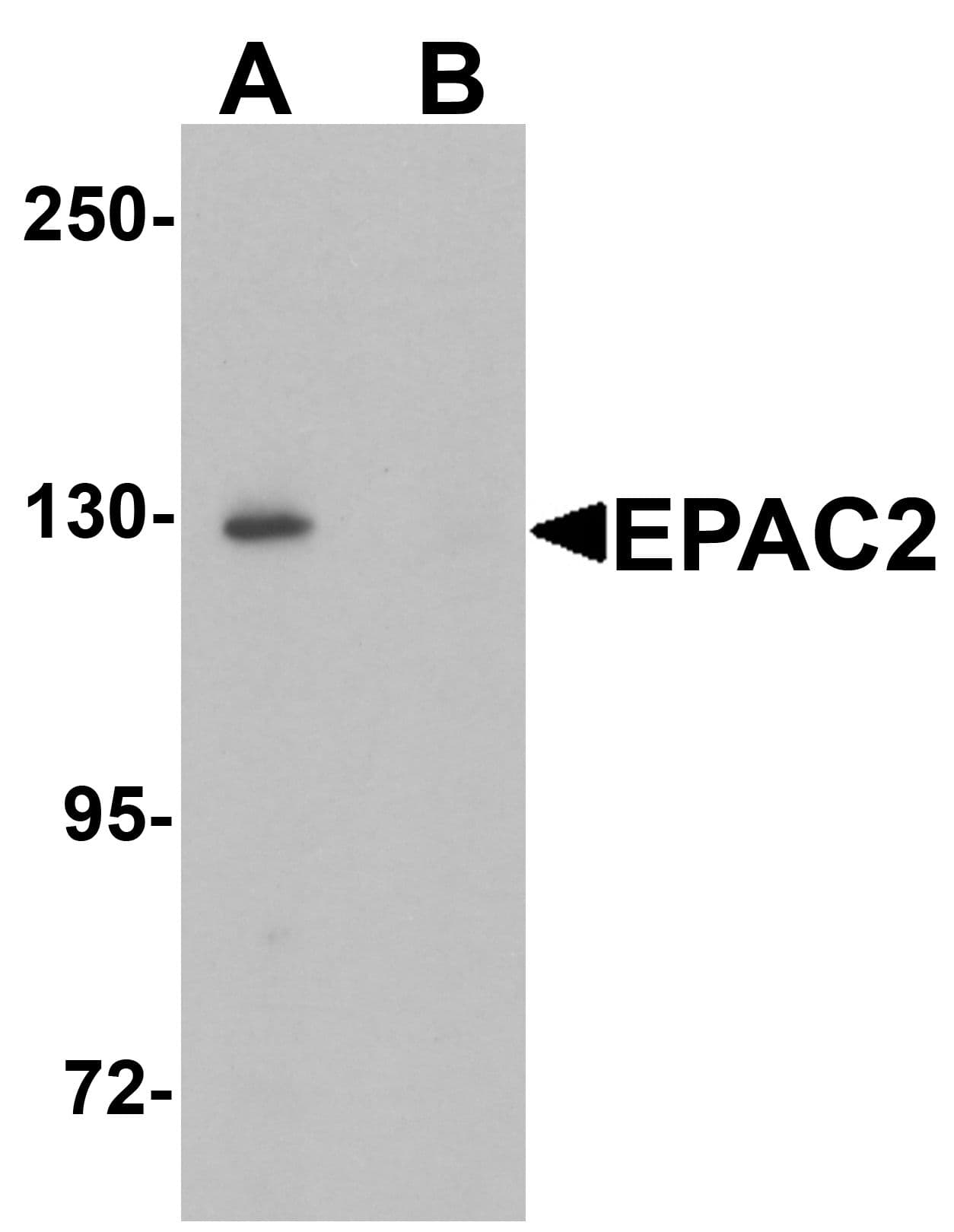 IHC-plus™ Polyclonal Rabbit anti-Human RAPGEF4 / EPAC2 Antibody (IHC, IF, WB)