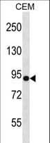 Polyclonal Rabbit anti-Human NLGN4Y Antibody (aa139-167, WB)