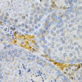 PDPK1 / PDK1 Antibody