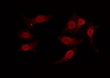 NCR1 / NKP46 Antibody