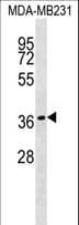 HEYL Antibody (aa26-54)