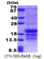 Human HnRNP-E1 / PCBP1 Protein (Recombinant His)