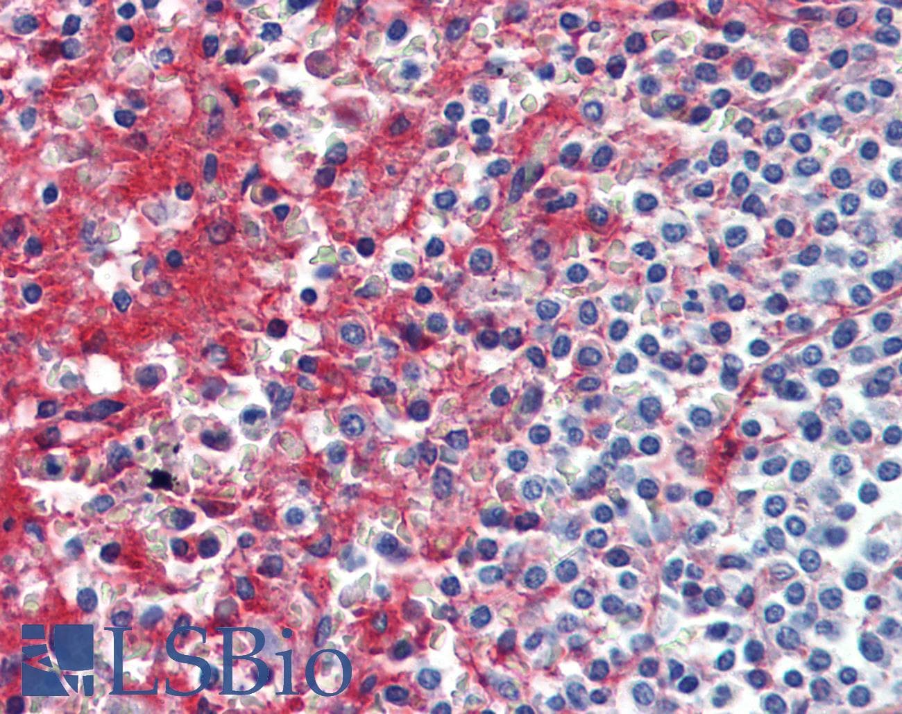 IHC-plus™ Collagen IV Antibody