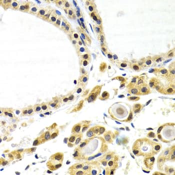 ATF2 Antibody