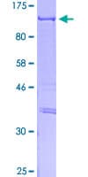 Human CLOCK Protein (Recombinant GST)