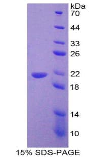 Human CRH / CRF Protein (Recombinant His-T7)