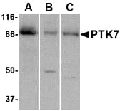 IHC-plus™ Polyclonal Rabbit anti-Human CCK4 / PTK7 Antibody (IHC, IF, WB)
