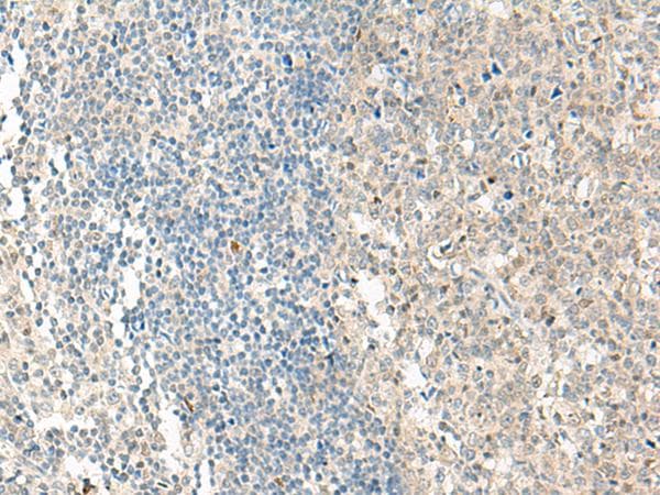 NPBWR1 / GPR7 Antibody