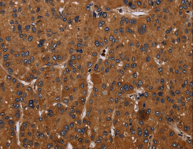 CYBB / NOX2 / gp91phox Antibody