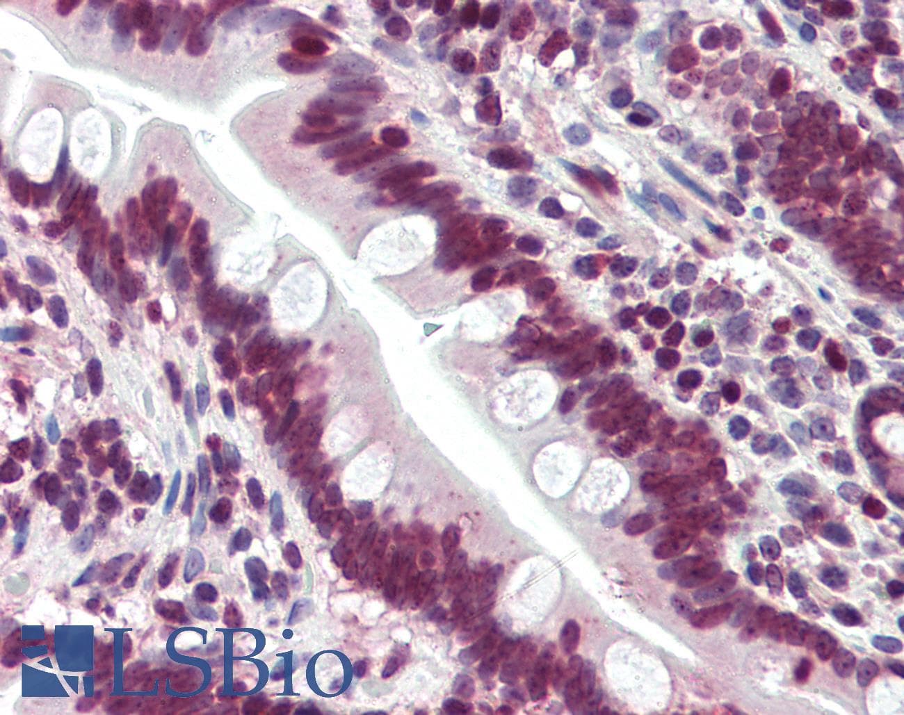IHC-plus™ Polyclonal Rabbit anti-Human CerS6 / LASS6 Antibody (IHC, IF, WB)