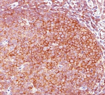 BCL10 / BCL-10 Antibody (aa122-168, clone BL10/411, Ready-to-Use)