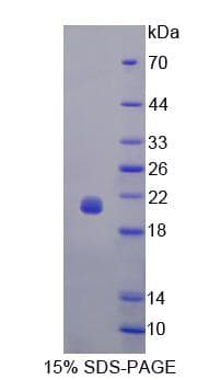 Human AGT / Angiotensinogen Protein (Recombinant His)