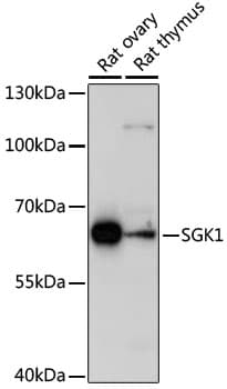 SGK1 / SGK Antibody