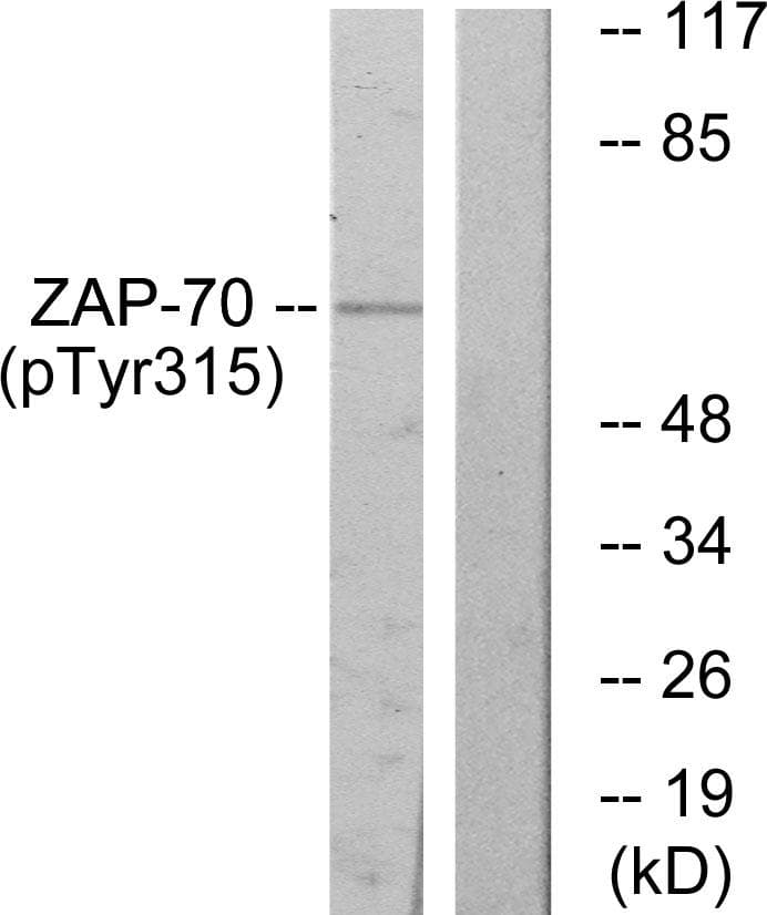 ZAP70 Antibody (phospho-Tyr315)
