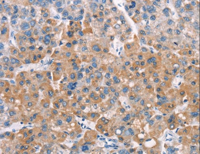 LATS2 Antibody