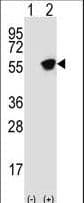 Polyclonal Rabbit anti-Human GFAP Antibody (aa381-410, WB)