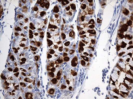 Monoclonal Mouse anti-Human TFF1 / pS2 Antibody (clone OTI2C8, aa25-84, IHC)