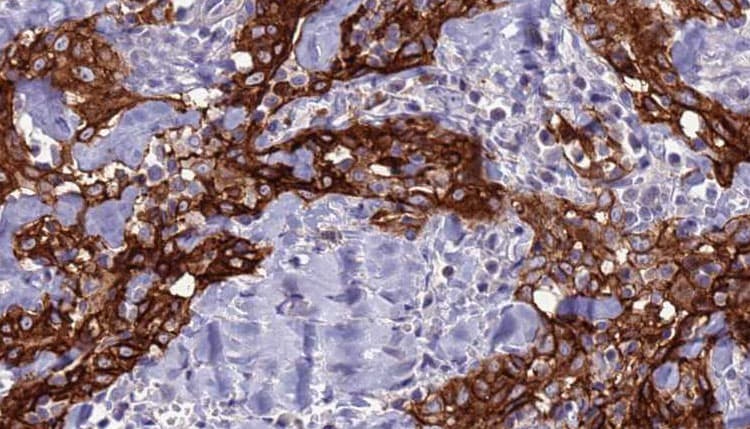 SLC2A2 / GLUT2 Antibody