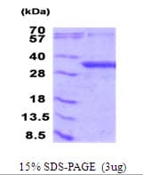 Human NFU1 Protein (Recombinant His)