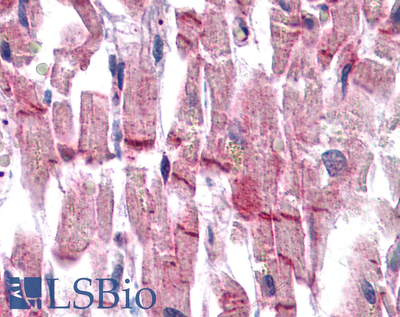 IHC-plus™ VCL / Vinculin Antibody