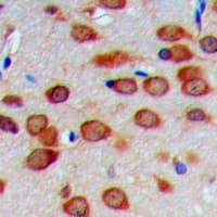 Polyclonal Rabbit anti-Human COXIV / COX4 Antibody (N-Terminus, IHC, IF, WB)