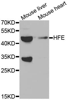 Polyclonal Rabbit anti-Human HFE Antibody (IHC, IF, WB)