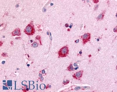 PathPlus™ NEK7 Antibody (Kinase Domain)