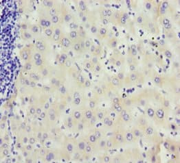 MCCC2 / MCCB Antibody