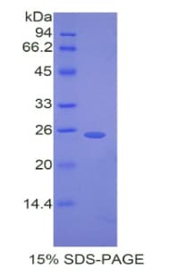 Mouse DSC1 / Desmocollin 1 Protein (Recombinant His)