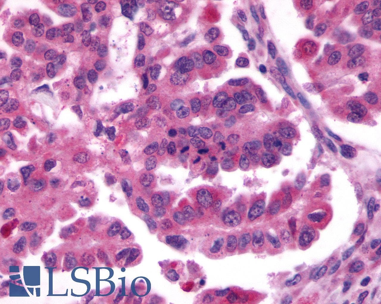 PathPlus™ Polyclonal Rabbit anti-Human CXCR4 Antibody (N-Terminus, IHC)