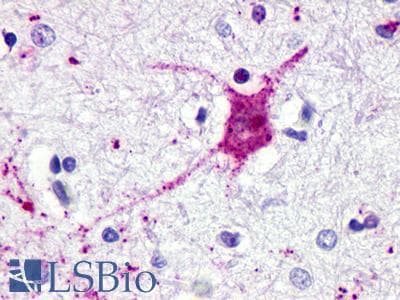 PathPlus™ GPR62 Antibody (Cytoplasmic Domain)
