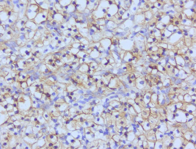 Monoclonal Mouse anti-Human CTNNB1 / Beta Catenin Antibody (clone UMAB15, Carrier-free, IHC, IF, WB)