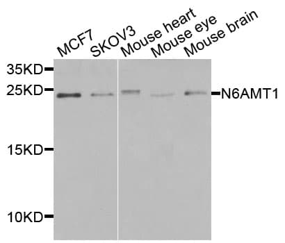 Polyclonal Rabbit anti-Human N6AMT1 Antibody (IHC, IF, WB)