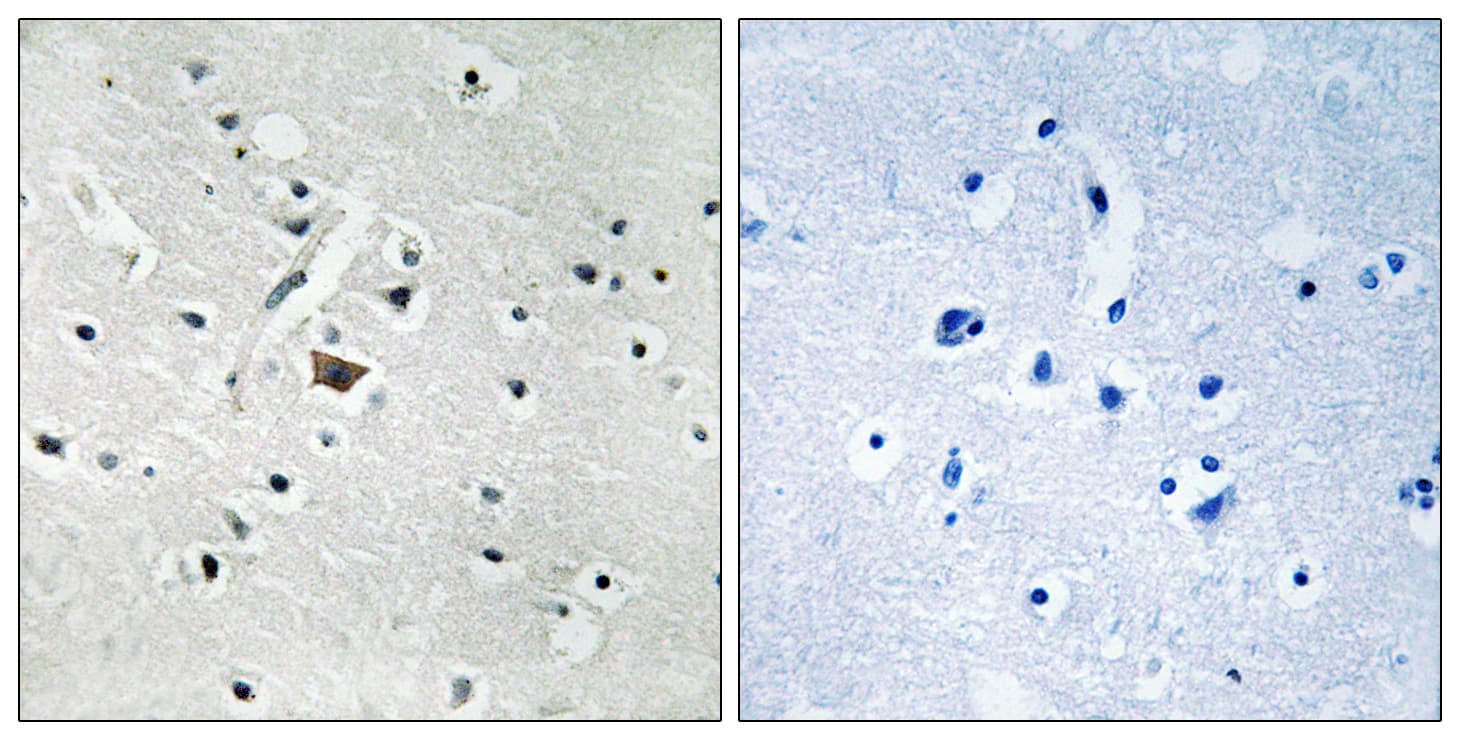 PLD2 / Phospholipase D2 Antibody (phospho-Tyr169)