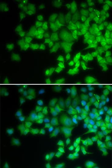 P40PHOX / NCF4 Antibody