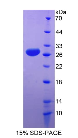 Human APOA4 Protein (Recombinant His-T7)