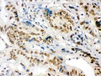 NONO / P54NRB Antibody