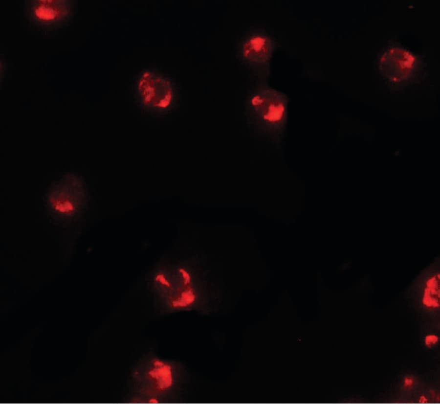 PIWIL2 Antibody