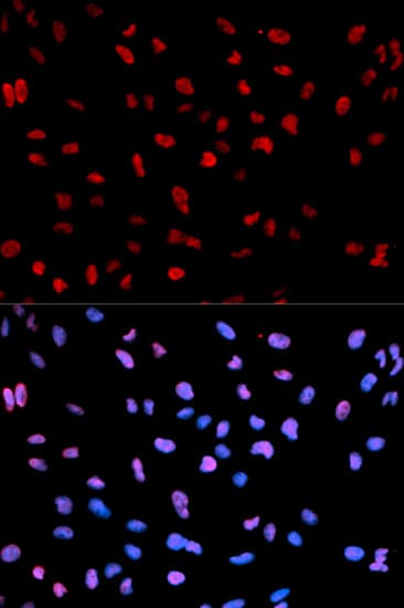 Polyclonal Rabbit anti-Human MEF2C Antibody (phospho-Ser396, IF, WB)