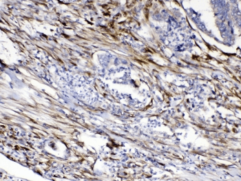 Polyclonal Rabbit anti-Human CYGB / Cytoglobin Antibody (IHC, WB)