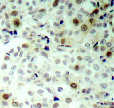 CDK2 Antibody (phospho-Thr160)