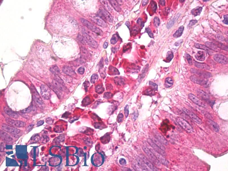 IHC-plus™ Polyclonal Rabbit anti-Human AMBRA1 Antibody (aa1-50, IHC, WB)