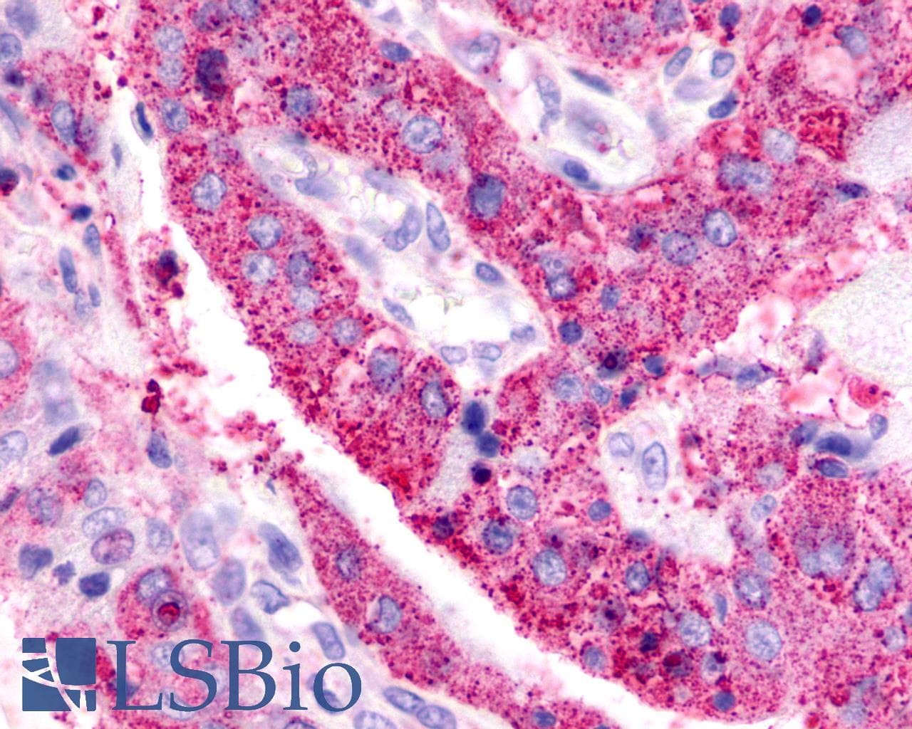 PathPlus™ ADGRB3 / BAI3 Antibody (C-Terminus)
