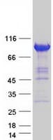 Human ZW10 Protein (Recombinant Myc-DDK (Flag))