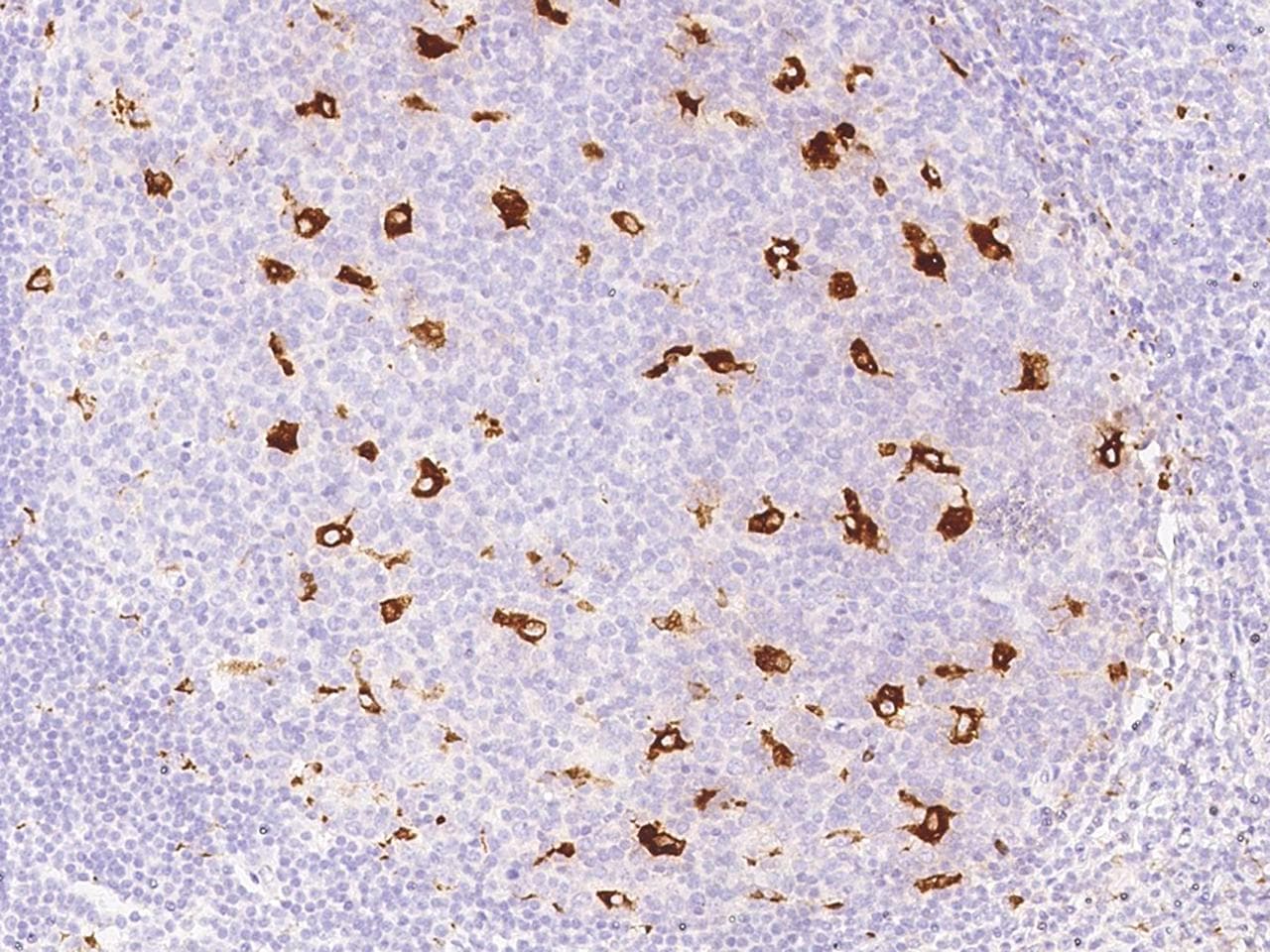 Monoclonal Mouse anti-Human CD68 Antibody (clone 11, Preservative Free, IHC)