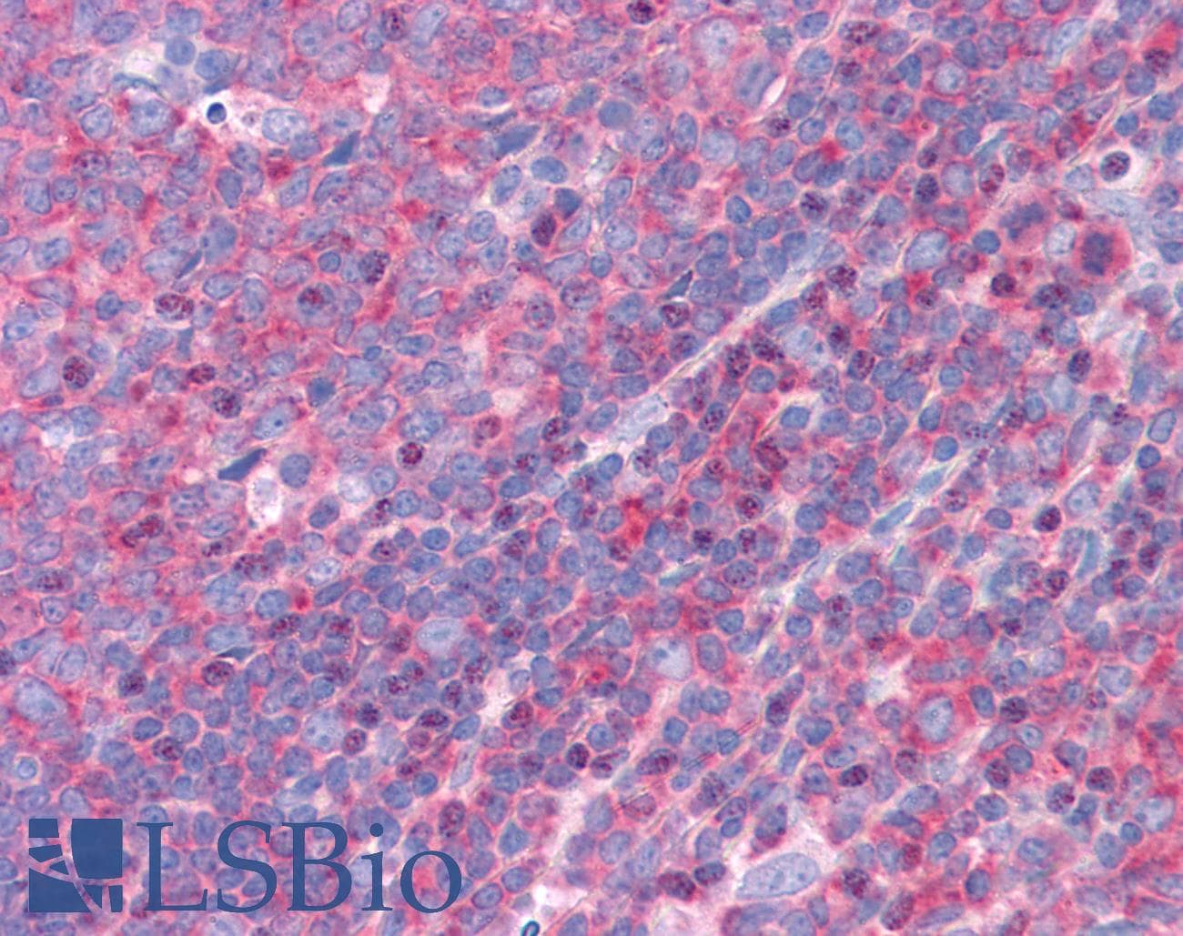IHC-plus™ FNBP1 / FBP17 Antibody (aa132-145)