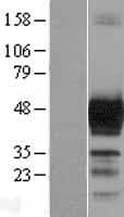 DCX / Doublecortin Protein (Over-Expression Lysate Myc-DDK (Flag))